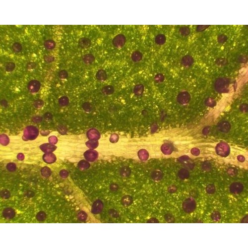 Bresser Microscope Advance ICD 10-160x